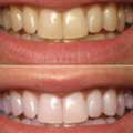 Achieve A Brighter, Radiance-Boosting Smile In Dubai &mdash; AFFORD Clinic In Al Nahda &mdash; Dubai