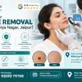INR 2000,  Mole Removal Near Malviya Nagar, Jaipur For A Visible Facial Mole