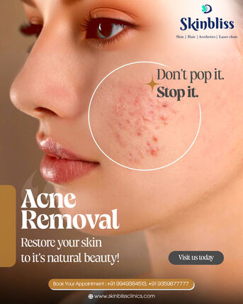 Hyderabad, Health, Chemical Peel Treatment In Hyderabad