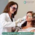 Laser Hair Removal Madison - Avalon Family Care