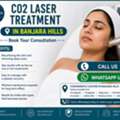 INR 4000,  Looking For CO2 Laser Near Somajiguda? Enquire About Treatment Cost