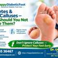 Diabetes & Foot Calluses &ndash; Why Should You Not Ignore Them?-Dr Uday Ravi