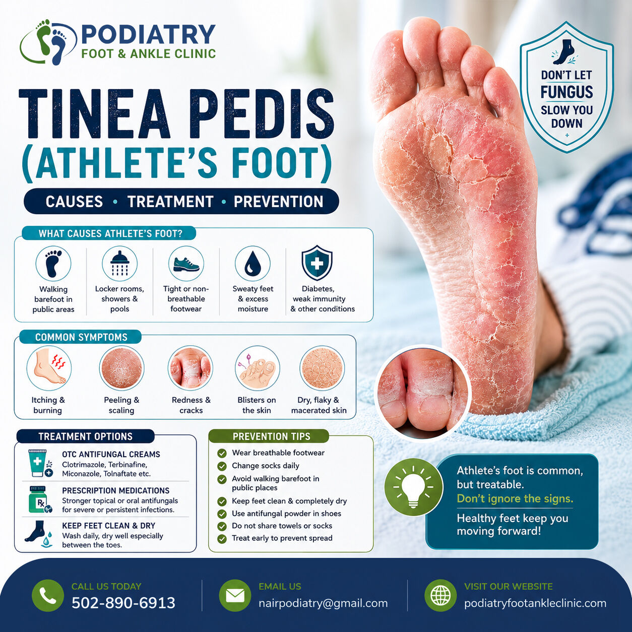 Washington DC, Medical, Athlete&rsquo;s Foot Symptoms You Shouldn&rsquo;t Ignore