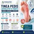 Athlete&rsquo;s Foot Symptoms You Shouldn&rsquo;t Ignore