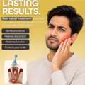 Braces, Root Canal & Dental Implants
