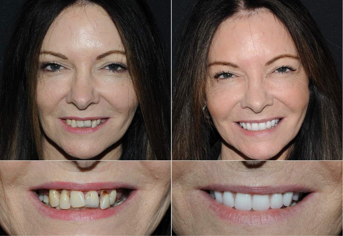 Sydney, Dental, Sydney Implant Studio