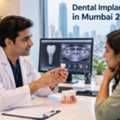 Dental Implant Cost In Mumbai 2026: What Expats Should Know
