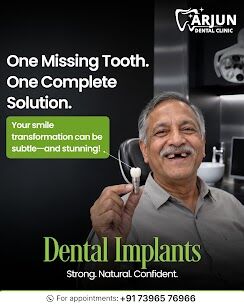 Hyderabad, Dental, Dental Implants Clinic In Manikonda | Arjun Dental
