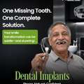 Dental Implants Clinic In Manikonda | Arjun Dental