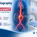 Can CT Angiography Detect An Aortic Aneurysm?