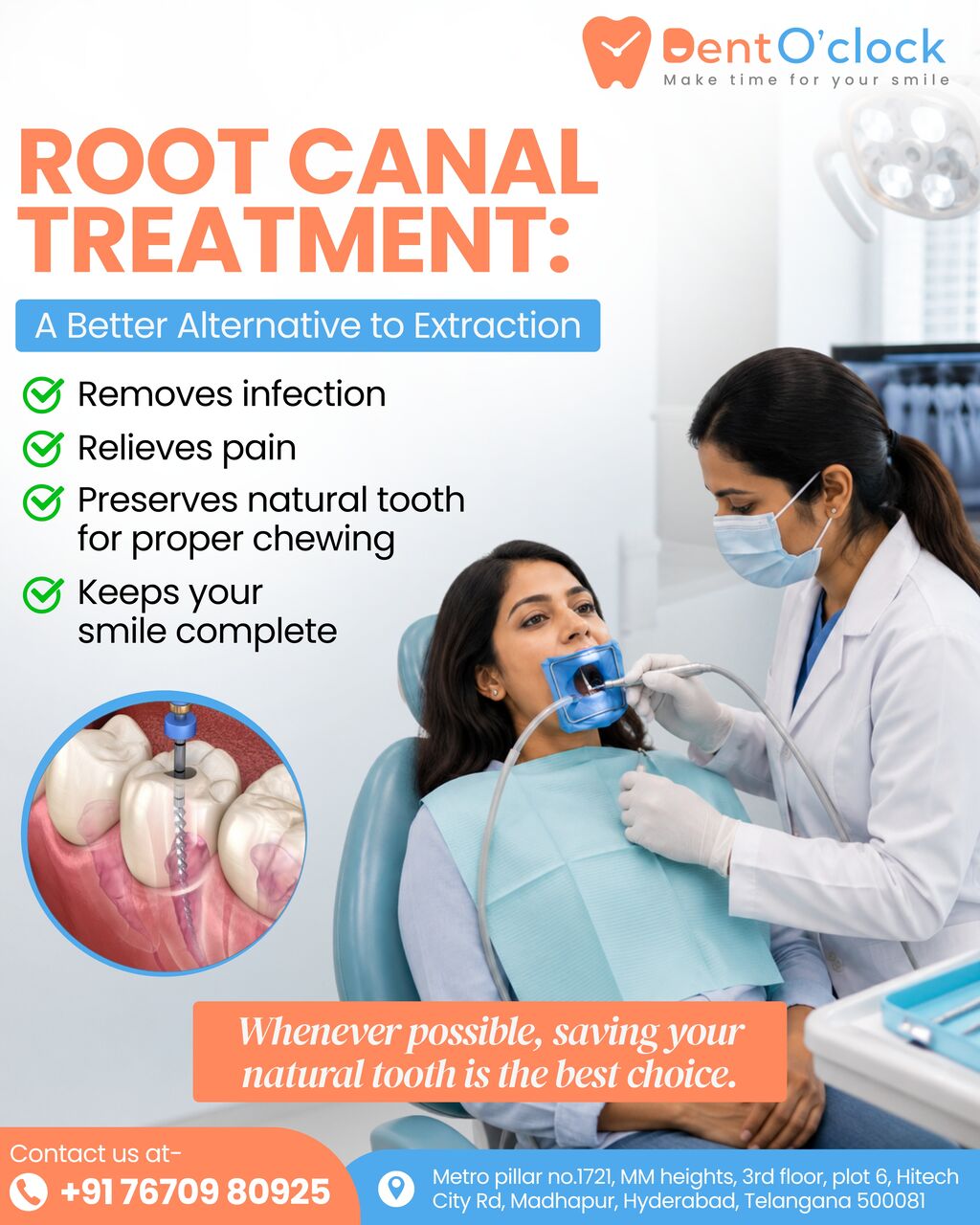 Hyderabad, Dental, DentO&rsquo;clock Dental Care - Best Dental Clinic In Madhapur