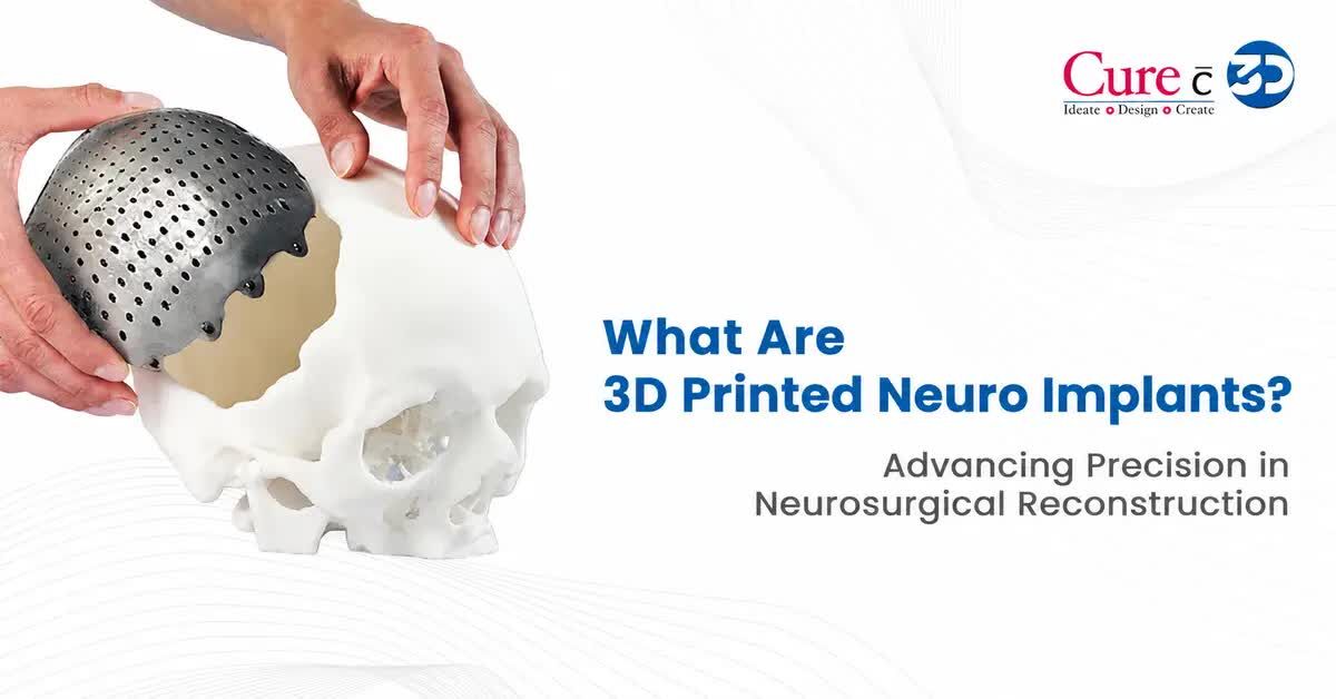 New Delhi, Medical, Professional Medical Titanium 3D Printing Technology