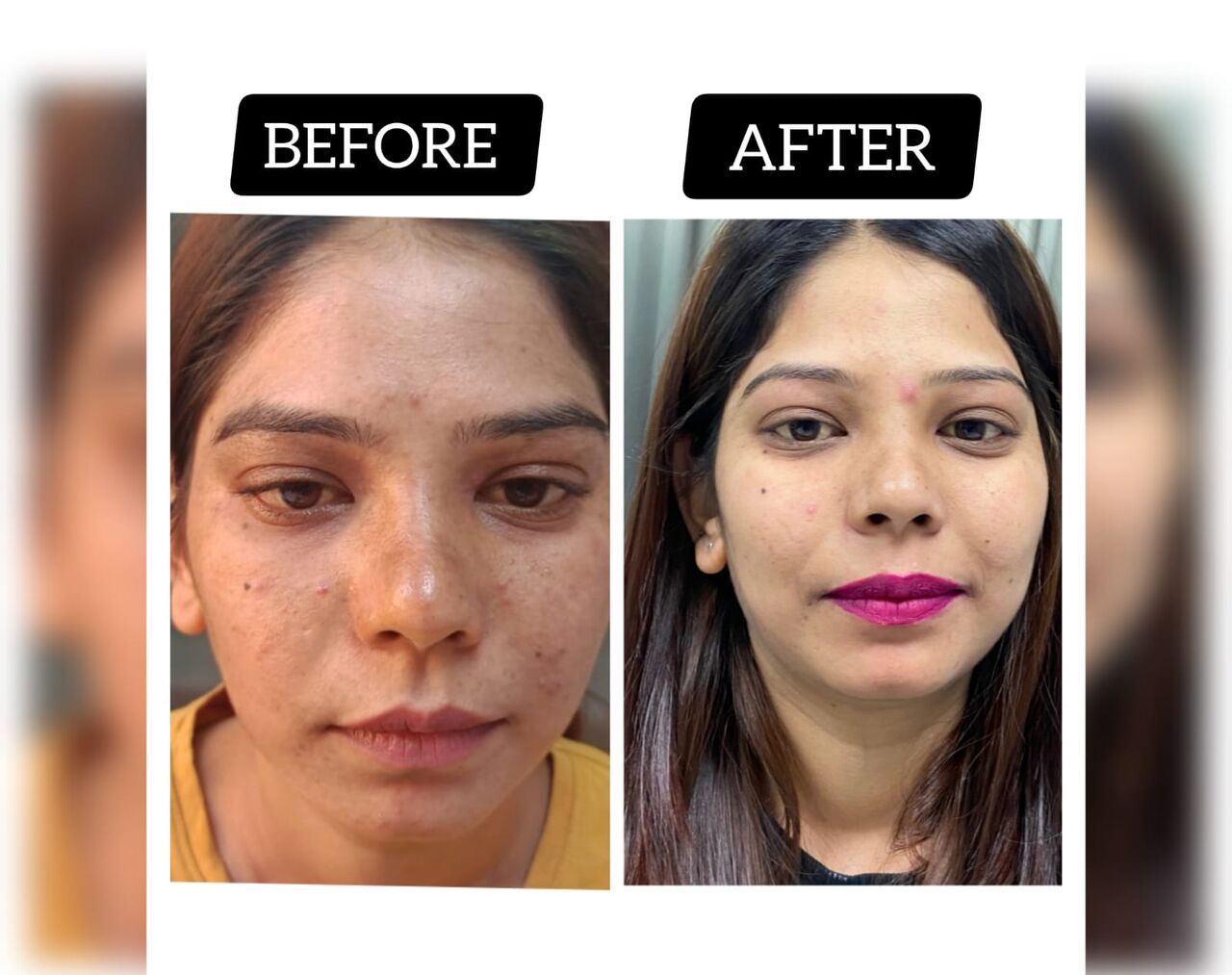 New Delhi, Health, Skin Treatment Clinic In Delhi