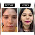 Skin Treatment Clinic In Delhi