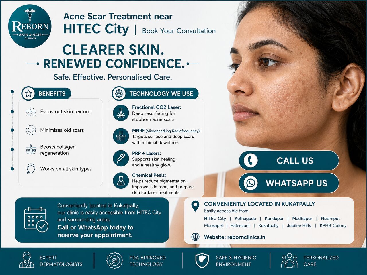 Hyderabad, Health & Beauty Items, INR 2499,  Acne Scar Treatment Near Hitech City &ndash; Enquire About Treatment & Cost