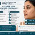 INR 2499, Acne Scar Treatment Near Hitech City – Enquire About Treatment & Cost