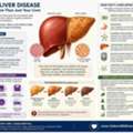 Improving Liver Health Through Integrative Care