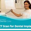 CBCT Scan For Dental Implants &ndash; Detailed 3D Dental Imaging