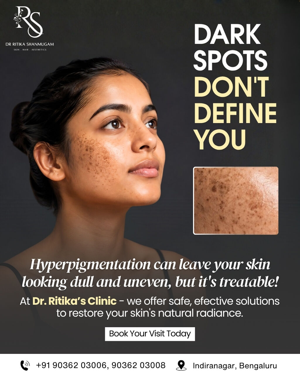 Bangalore, Health, Your Trusted Destination For Comprehensive Skin