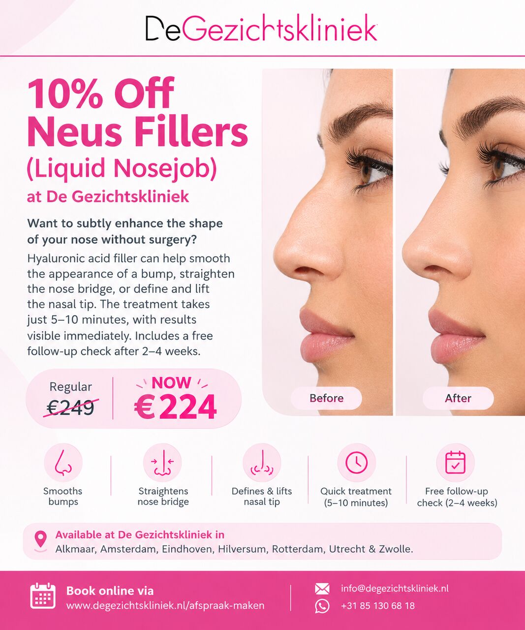 Amsterdam, Health, ✨ 10% KORTING OP NEUSFILLERS (LIQUID NOSEJOB) BIJ DE GEZICHTSKLINIEK! ✨
