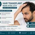 INR 29999,  Hair Transplant Near HITEC City &mdash; Ask About Your Cost