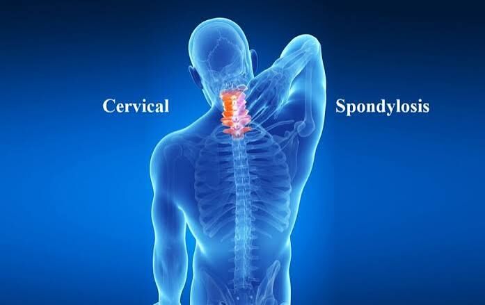 Gurgaon, Health, Cervical Spondylosis Physiotherapy In Gurgaon For Working Professionals
