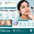 INR 5000,  Vitiligo Treatment Near Civil Lines Jaipur For White Patches