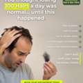 Expert Hair Specialist In Hyderabad For Hair Fall & Scalp Care