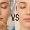 PRP Vs. Dermal Fillers: Which Is Right For Restoring Volume And Refreshing Your Skin?
