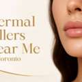 Looking For Dermal Fillers Near Me For Under Eye & Cheeks? Natural Lift At Tight Clinic