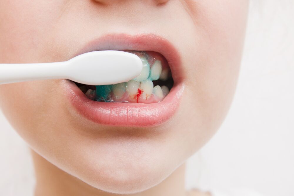 Al Nahda, Health, Bleeding Gums When Brushing - AFFORD Clinic In Al Nahda Dubai