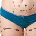 PKR 180,  Liposuction In Islamabad: What Makes Body Contouring Different From Weight Loss?