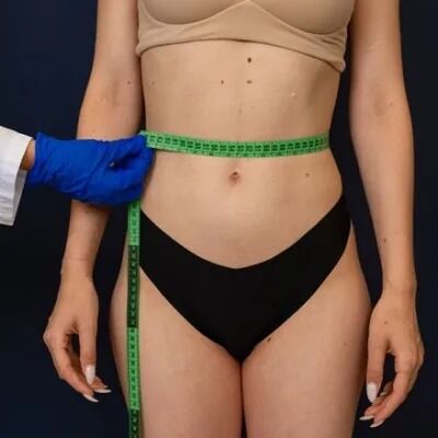 Islamabad, Health & Beauty Items, PKR 180,  Liposuction In Islamabad: What Makes Body Contouring Different From Weight Loss?