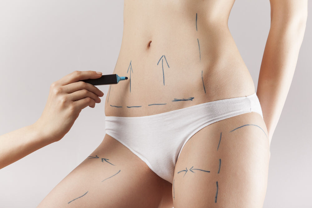 Islamabad, Health & Beauty Items, PKR 180,  Liposuction In Islamabad: What Makes Body Contouring Different From Weight Loss?