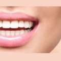 Custom Veneers In Hillsborough To Enhance Smile Shape, Color, And Overall Balance
