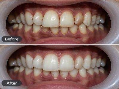 Kolkata, General, AB Dentologic &ndash; Professional Dental Services For A Healthier Smile