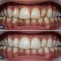 AB Dentologic – Professional Dental Services For A Healthier Smile