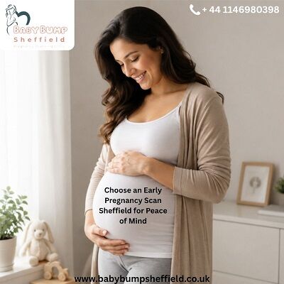 London, Health, Choose An Early Pregnancy Scan Sheffield For Peace Of Mind