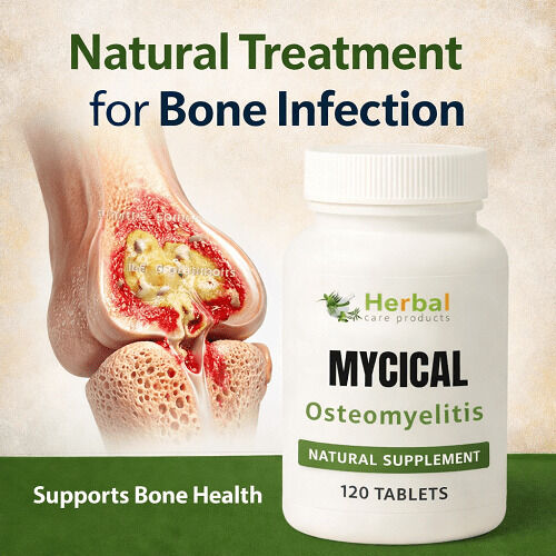 New York, Health, Best Herbal Supplements For Osteomyelitis: What To Consider Before Buying