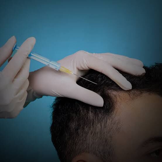 Mumbai, Health, Affordable Hair Transplant In Dehradun &mdash; Quality You Can Trust