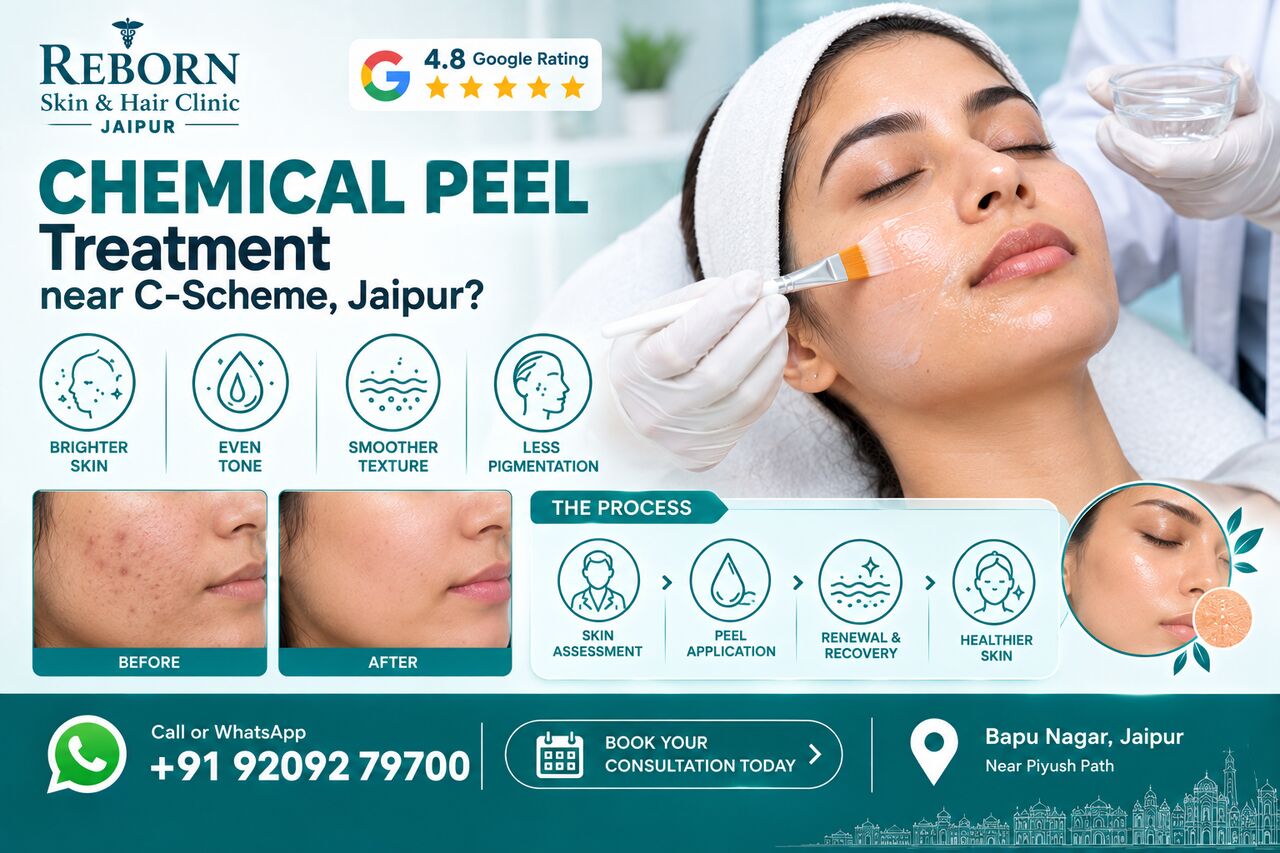 Jaipur, Health & Beauty Items, INR 3500,  Chemical Peel Treatment Near C-Scheme For Pigmentation