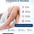 Supporting Healthier Legs With Specialist Evaluation And Personalised Care