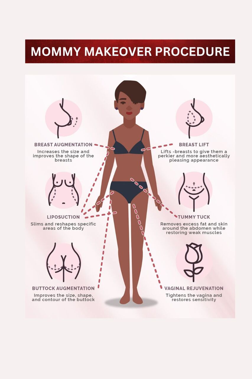 Dubai, Health, Mommy Makeover In Dubai - Dr. Mohan Plastic Surgeon