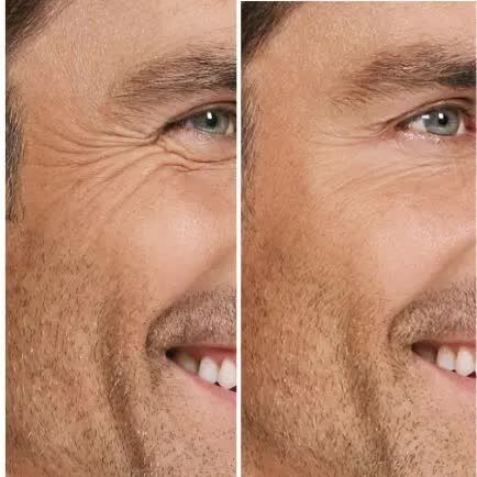 Dubai, Health, Botox For Men In Dubai - Plasticsurgerybydrpunam