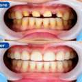 AB Dentologic – Comprehensive Smile Care In Newtown