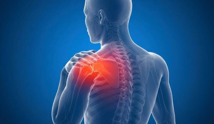 Gurgaon, Health, Physiotherapy For Frozen Shoulder & Back Pain In Gurgaon