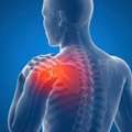 Physiotherapy For Frozen Shoulder & Back Pain In Gurgaon