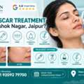 INR 5000,  Acne Scar Treatment Near Ashok Nagar Jaipur For Deep Scars