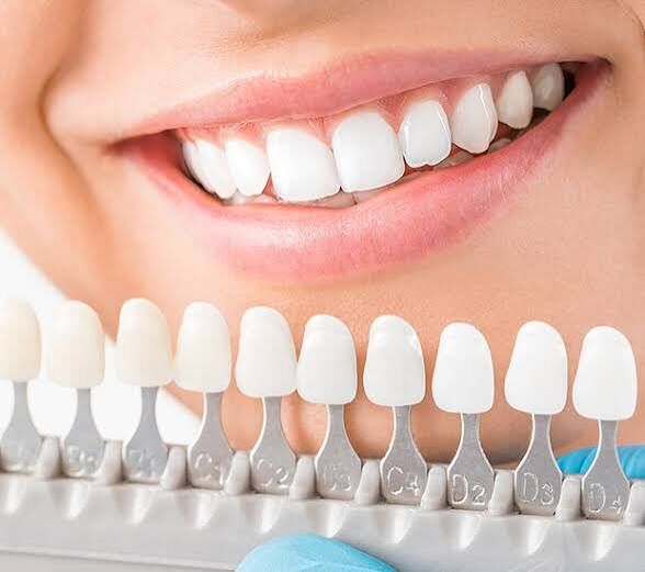 Miami, Dental, Professional Teeth Whitening & Cosmetic Dentistry In Miami