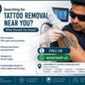 INR 2999,  Tattoo Removal Treatment Near Jubilee Hills, Hyderabad | Ask About Cost